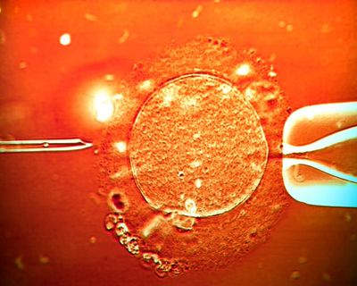 Sperm from cancer-risk donor used to conceive at least 67 children across Europe