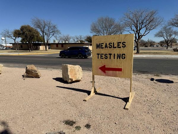 As Texas’s measles outbreak slows, officials warn of rise in other states