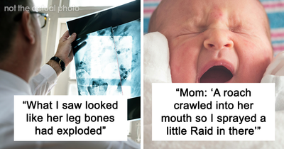 64 Times Medical Workers Pretended To Be Calm While Seeing Something Truly Unbelievable