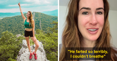 Woman Gets Horrifying 7-Year Infection After Her Boyfriend Farts In Her Face