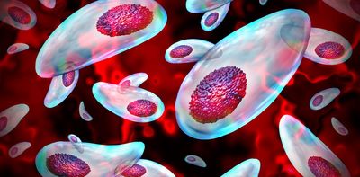 A common parasite can decapitate human sperm − with implications for male fertility