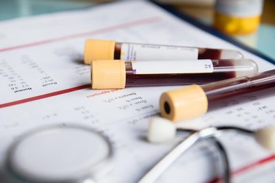 NHS to roll out ‘revolutionary’ blood test for lung cancer