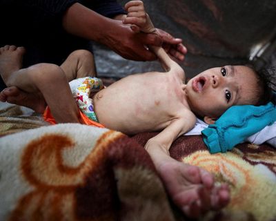 If the horrors unfolding in Gaza are not a red line for Australia to take stronger action then I don’t know what is