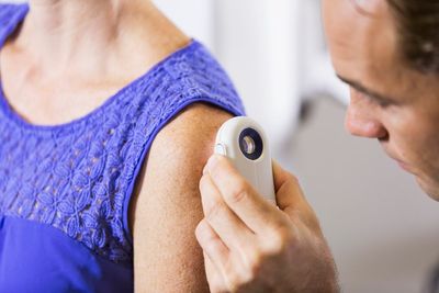 ‘Transformative’ one-time therapy could help skin cancer patients live longer