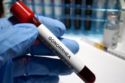 Expert warns of spread of super-gonorrhoea resistant to antibiotics