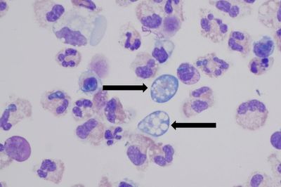 A woman contracted a fatal brain-eating ameba after rinsing her sinuses. Here’s how to avoid it