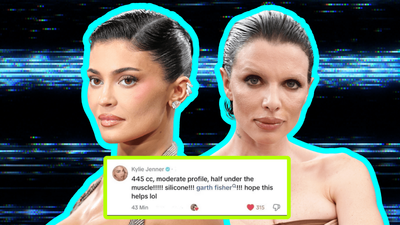 From Kylie Jenner To Julia Fox, We’re In A Radical Era Of Transparency Over Cosmetic Work