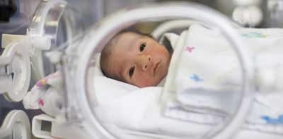 Premature babies are given sucrose for pain relief – but new research shows it doesn’t stop long-term impacts on development