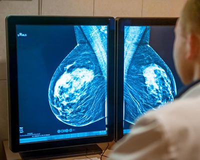 Key takeaways from world’s largest cancer conference in Chicago