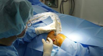 Knee Stem Cell Injection Gains Attention as an Innovative Treatment