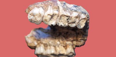 2-million-year-old pitted teeth from our ancient relatives reveal secrets about human evolution