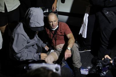 British photographer needed emergency surgery after he was shot by sponge bullet during LA protests