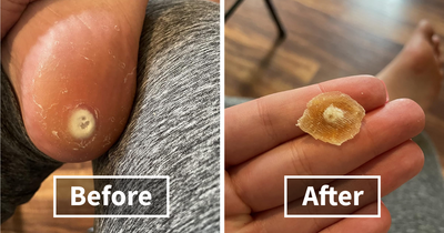 Forget The ‘Meh’ Solutions, These 22 Beauty Buys Are The Gold Standard For Embarrassing Problems