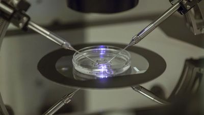 Sperm donation policies in Europe called into question after cancer gene scandal