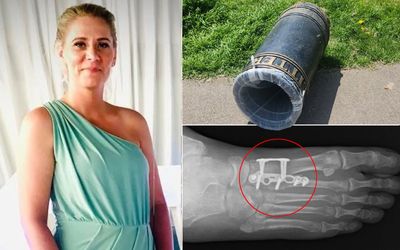 Mother sues London council after 150kg park litter bin crushes her foot during dog walk