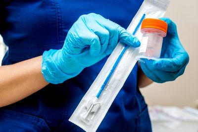 NHS makes major change to cervical cancer screenings for younger women