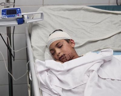 Gaza doctor and son evacuated after husband and nine children killed in Israeli strike