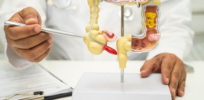 Appendix cancer rising among younger generation – new study