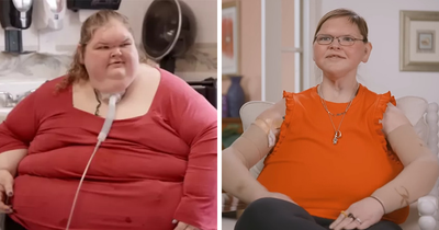 Shocking Transformation Of ‘1000-lb Sisters’ Star Goes Viral After She Reveals ‘Terrifying’ 8-Hour Surgery