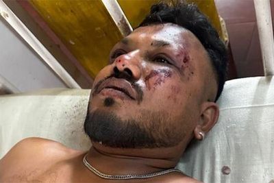 Miracle in seat 11A: British national survives Air India plane crash