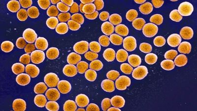 Superbugs evolve inside the human body — tracking them in real time could help save patients, scientists say