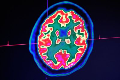 AI sometimes thinks like humans, scientists reveal