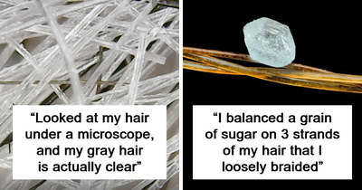 People Who Have A Microscope Share The Most Interesting Things They Observed Up Close (New Pics)