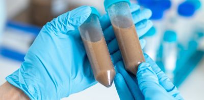 Could faecal transplants cause long-term health problems?