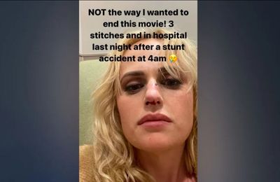 Rebel Wilson feared she'd be 'permanently disfigured' after 'freak accident' on set