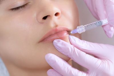 Crackdown urged as unsafe cosmetic fillers sold online for £20