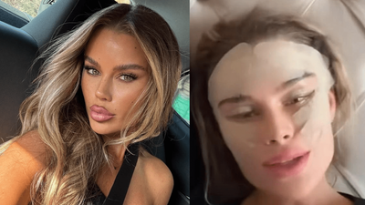 $500K & Going Blind: Skye Wheatley Spills On Her Cosmetic Surgery Saga