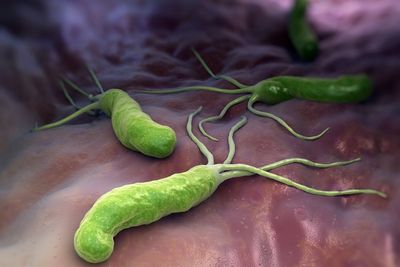 Gut bacteria may hold key to protecting brain against Alzheimers