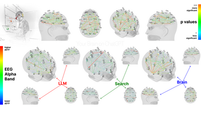 New research says using AI reduces brain activity – but does that mean it's making us dumber?