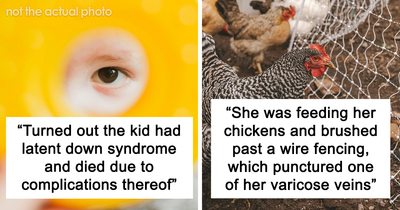 “They’d Perforated Her Uterus”: 20 Medical Examinations That Showed Unexpected Results