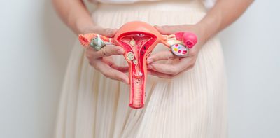 Inaccurate and misogynistic: why we need to make the term ‘hysterectomy’ history