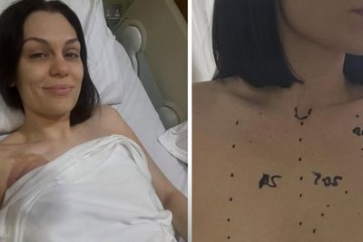Jessie J shares tearful update after undergoing breast cancer surgery