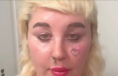 Amanda Bynes turns to Ozempic to achieve weight-loss goal