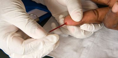 US approves twice-yearly injection for HIV prevention – what you need to know about lenacapavir