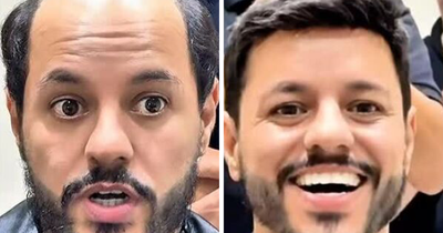 Brazilian Stylist Helps Men With Baldness Look Like Themselves Again, And Here Are 40 Of His Most Impressive Results
