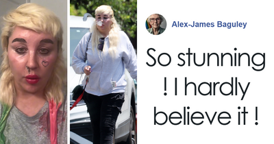 Amanda Bynes Steps Out After Revealing She’s Using Ozempic And Why, Sparking Mixed Reactions