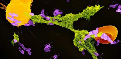 Mitochondria can sense bacteria and trigger your immune system to trap them – revealing new ways to treat infections and autoimmunity