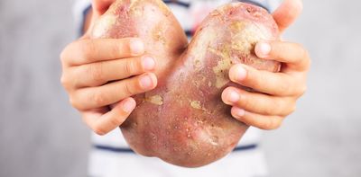 ‘Upcycled’ food is on the rise – here’s what you need to know