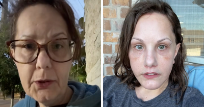 Woman’s Facelift Breaks The Internet After People Discover What She Looked Like Before
