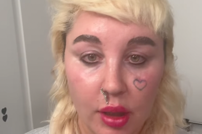 Amanda Bynes reveals she is taking Ozempic to ‘look better in paparazzi pictures’ in rare life update