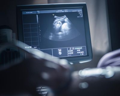 Test developed to identify women at increased risk of miscarriage