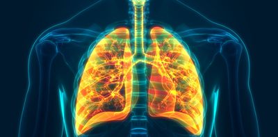 Lung cancer screening is about to start. What you need to know if you smoke or have quit