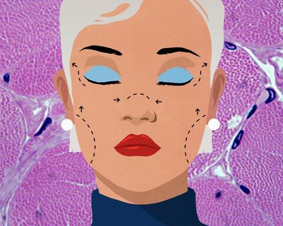 What is a deep plane facelift? Nipping into the buzzy cosmetic procedure