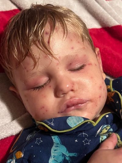 Toddler, 2, fighting for life after being stung 150 times by wasps while riding toy car