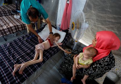 At least 66 children dead of malnutrition in Gaza amid Israel’s war