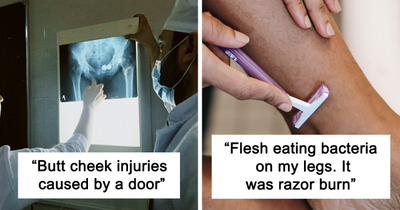 “What Is The Stupidest Reason You Went To Hospital?” (20 Answers)